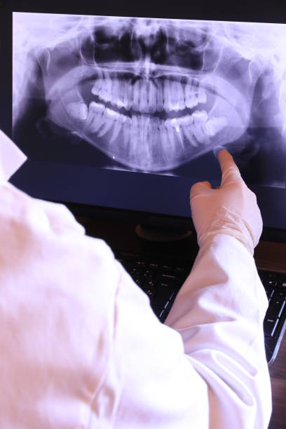 Best Emergency Dental Care for Broken or Chipped Teeth in Clearwater, SC