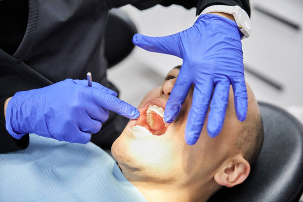 Best Emergency Tooth Extraction in Clearwater, SC